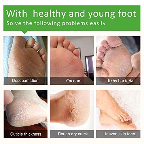 3 Pairs Foot Moisturizing Mask, Foot Moisturizing Socks to Repair Renew Booties