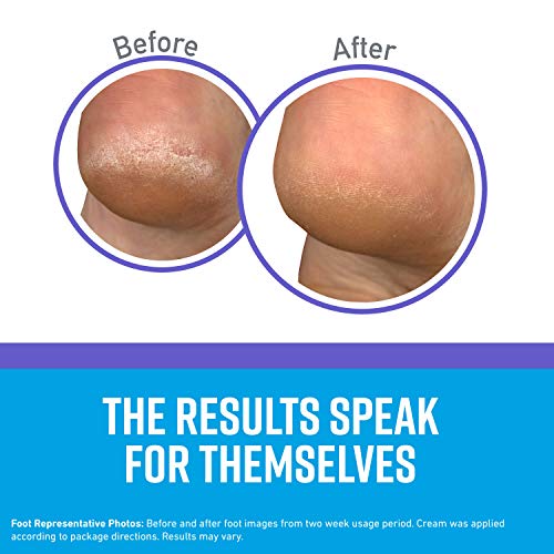 O'Keeffe's Healthy Feet Night Treatment Foot Cream, 3.0 Ounce Tube, (Pack of 1)