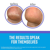 O'Keeffe's Healthy Feet Night Treatment Foot Cream, 3.0 Ounce Tube, (Pack of 1)