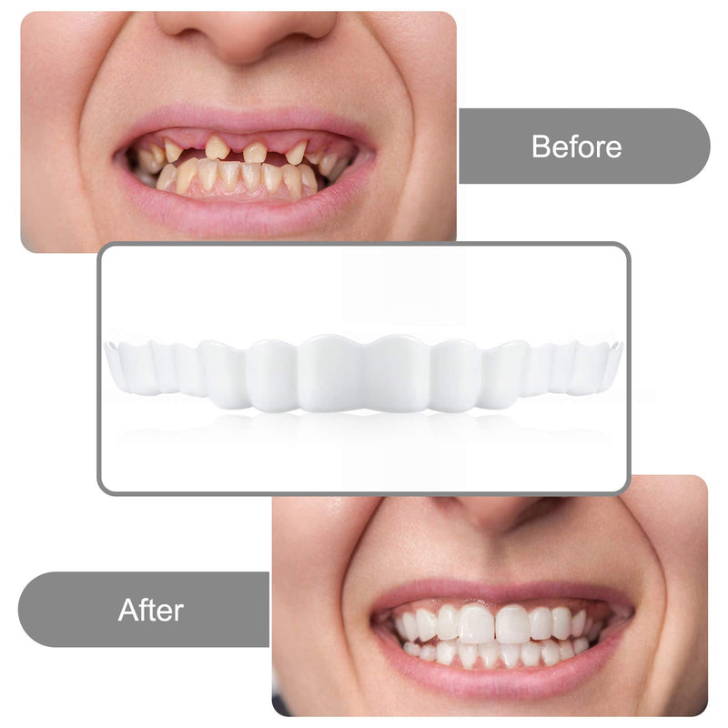 8 Pieces Instant Veneers Dentures Fake Teeth Smile Serrated Denture Teeth Top Fake Teeth with Mini White Tweezers for Men and Women