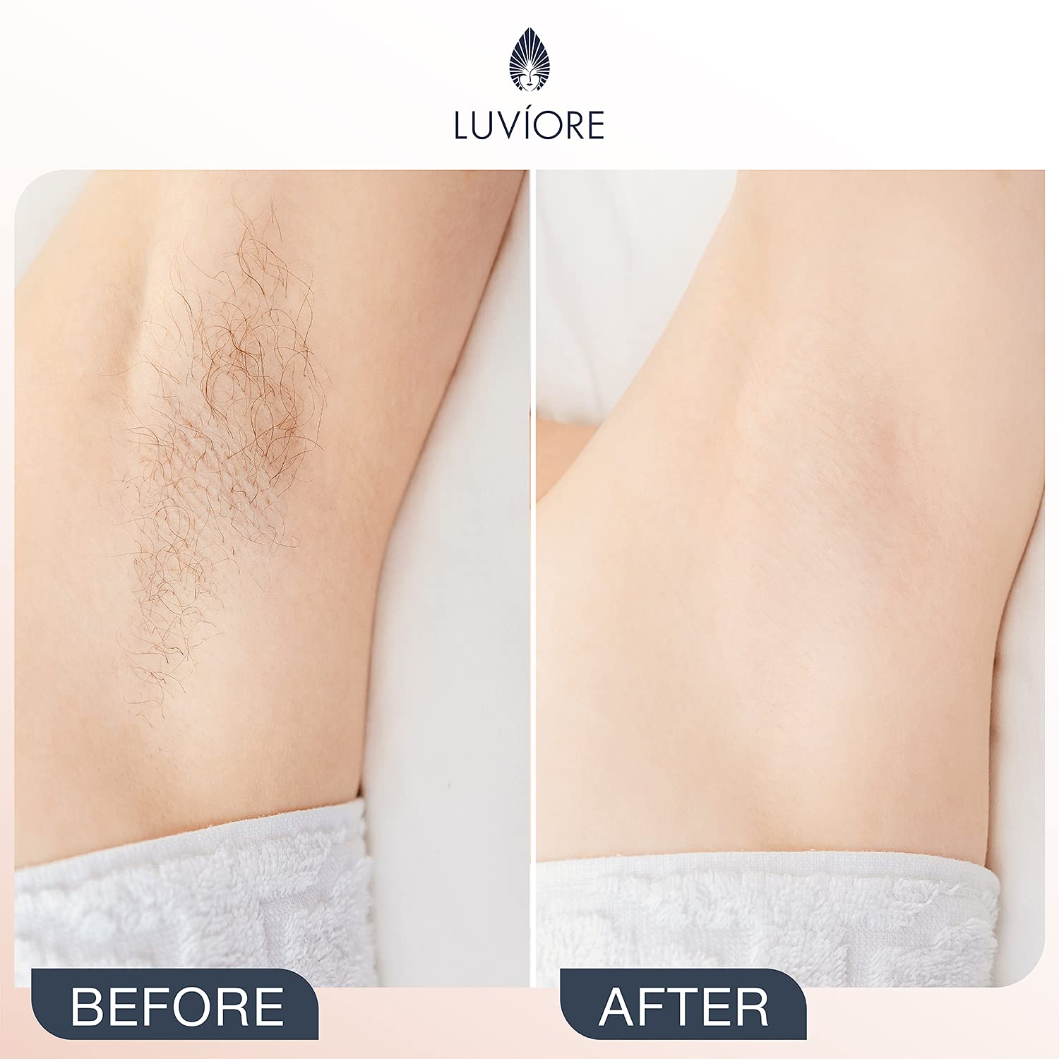 Luviore Ingrown Hair Treatment and After Shave Solution | Ingrown Hair Serum for Razor Burn and Razor Bump Treatment for Bikini Area | After Waxing Skin Care | Moisturizing Serum for Women & Men, 4oz