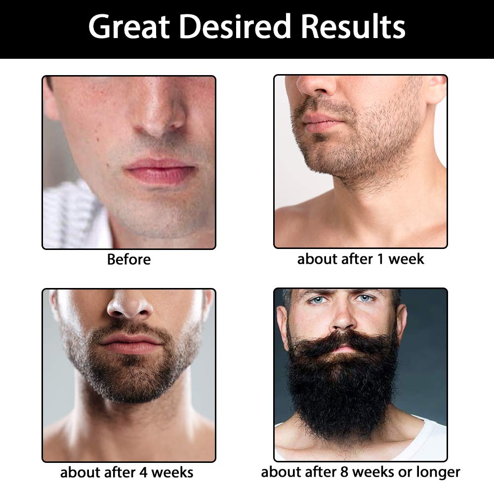 Beard Growth Kit,Beard Grooming Tools for Beard Rapid Growth and Density,Beard Growth Activator Serum +Beard Balm +Beard Cleanse, Beard Care Gift for Men Sandalwood Scent