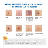 Ariella Removal Treatment-Made of Natural Plant Extracts-Simple and Easy to Apply Skin Tag Remover & Mole Corrector and Repair Lotion Set,