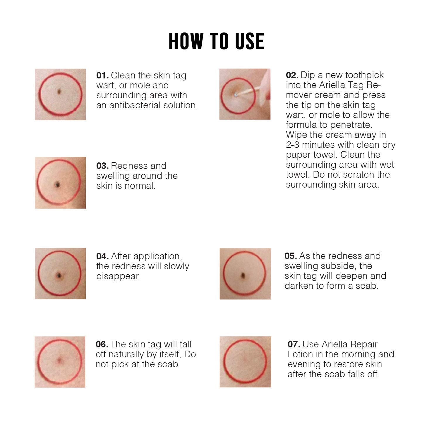 Ariella Removal Treatment-Made of Natural Plant Extracts-Simple and Easy to Apply Skin Tag Remover & Mole Corrector and Repair Lotion Set,