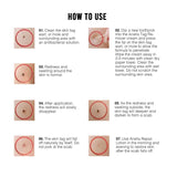 Ariella Removal Treatment-Made of Natural Plant Extracts-Simple and Easy to Apply Skin Tag Remover & Mole Corrector and Repair Lotion Set,