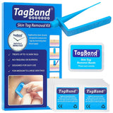 TagBand Skin Tag Removal Device for Medium to Large Skin Tags