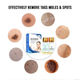 Ariella Removal Treatment-Made of Natural Plant Extracts-Simple and Easy to Apply Skin Tag Remover & Mole Corrector and Repair Lotion Set,