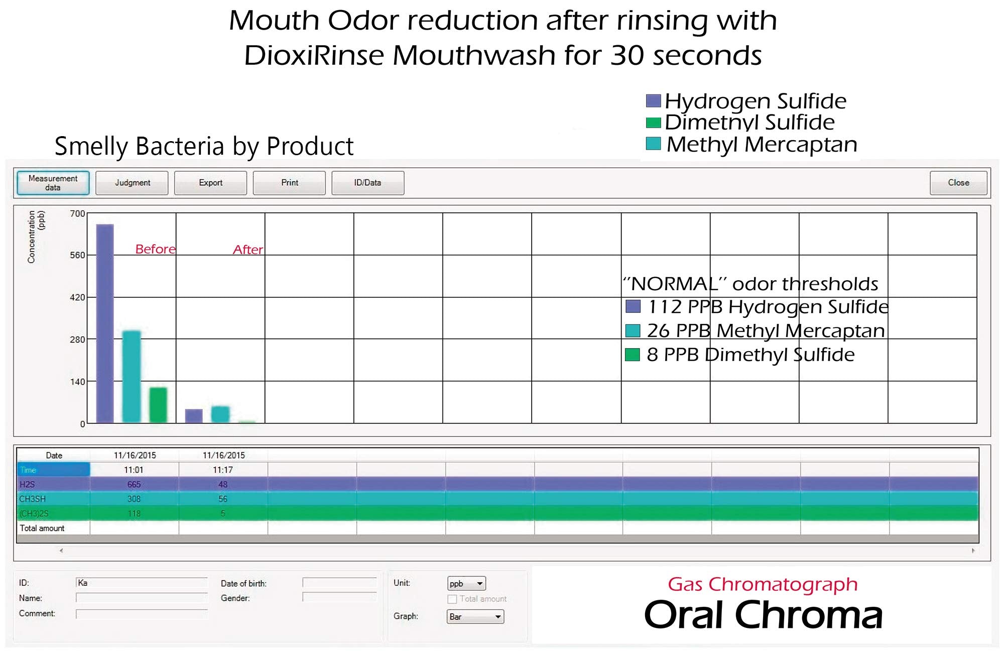 Sensitive Dental Care DioxiRinse Anti-Microbial Mouthrinse 32 Oz. New Boxed Design