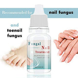 Fungus Stop, Anti Fungus Nail Treatment, Effective Against Nail Fungus, Anti Fungal Nail Solution 10ML