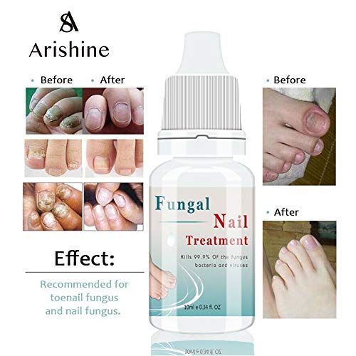 Fungus Stop, Anti Fungus Nail Treatment, Effective Against Nail Fungus, Anti Fungal Nail Solution 10ML