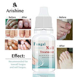 Fungus Stop, Anti Fungus Nail Treatment, Effective Against Nail Fungus, Anti Fungal Nail Solution 10ML