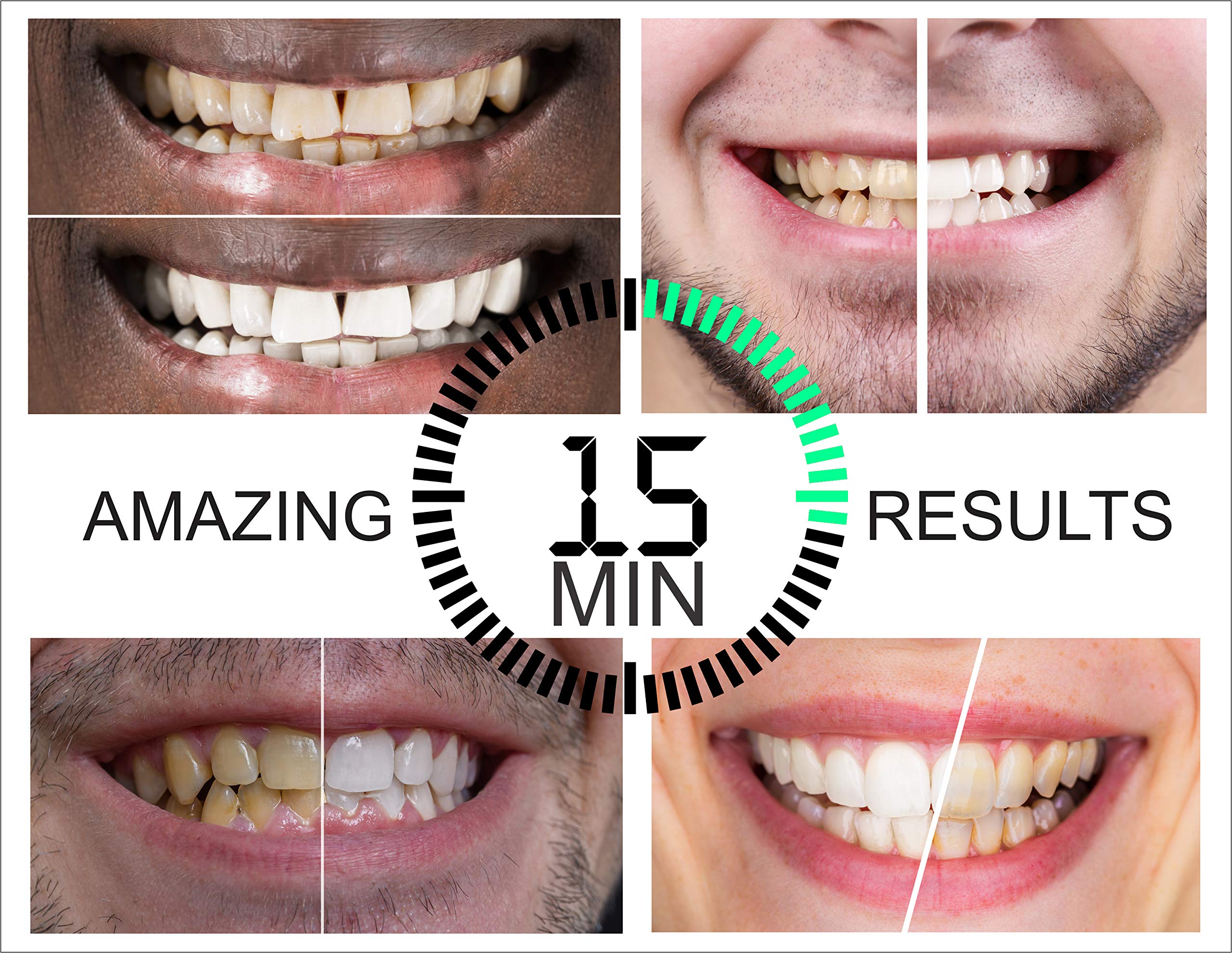 Polar Teeth Whitening Pen Kit Fast Acting Tooth Whitening Gel with a 5 X Teeth Whitening LED Light for 5 X The Whitening Acceleration