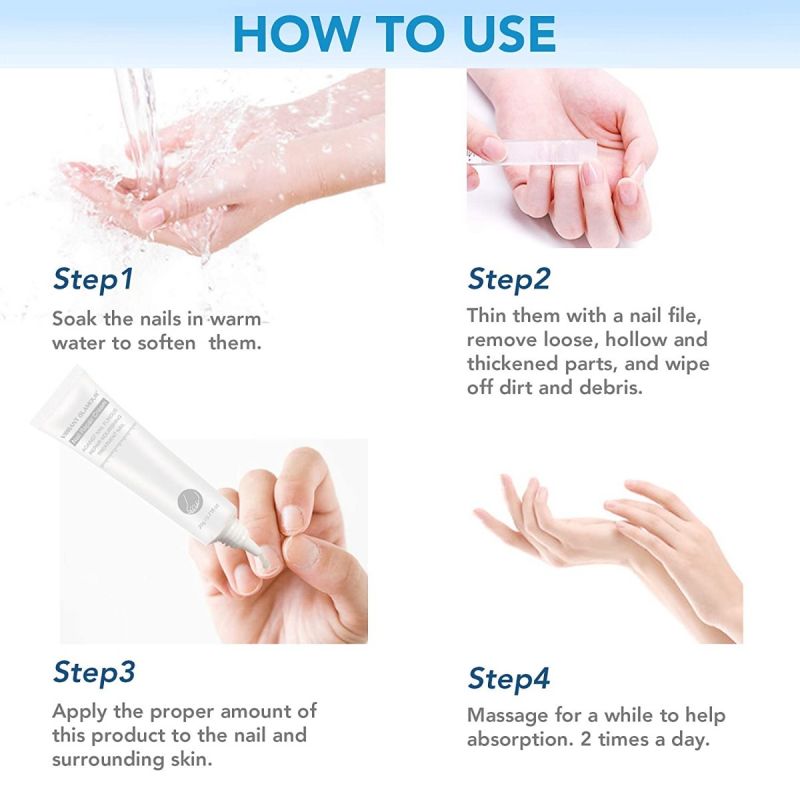 Toenail Fungus Treatment Cream, Nail Fungus Stop, Fingernail Fungus, Fungi Nail Fungus Remover, Maximum Strength Antifungal Cream