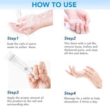 Toenail Fungus Treatment Cream, Nail Fungus Stop, Fingernail Fungus, Fungi Nail Fungus Remover, Maximum Strength Antifungal Cream