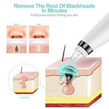 Blackhead Remover Vacuum with 5 Probes, JOMARTO Blackhead removal tool