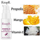 RtopR Propolis Repair Acne Serum, Acne Treatment Serum, Moisturizing Control Oil Anti-Acne Serum - Shrink Pores, Remove Scar Spot Cleaning Essence - Repair Skin