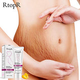 RtopR Mango Remove Pregnancy Scars, Stretch Mark Care Cream-Maternity Repair, Pregnancy Stretch Marks, Anti-Aging, Anti-Winkles Firming Body Creams, Prenatal, Postpartum