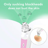 Blackhead Remover, Visual Electric Facial Pore Cleaner Phone Linked Display WiFi Beauty Device for Skin Care, Powerful Removal Blackhead Acne Extractor¡­