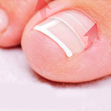 SUPVOX 120pcs Ingrown Toe Nail Correction Patch Paronychia Corrector File Elastic Patch Corrector
