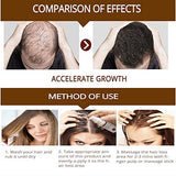 Hair Growth fluid, Hair Growth Serum, Hair Loss Prevention, Anti-Hair Loss Serum