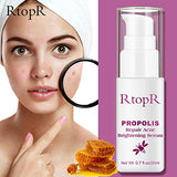 RtopR Propolis Repair Acne Serum, Acne Treatment Serum, Moisturizing Control Oil Anti-Acne Serum - Shrink Pores, Remove Scar Spot Cleaning Essence - Repair Skin