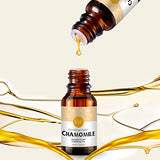 Chamomile Essential Oil 100% Pure Aromatherapy Oil for Diffuser, Perfumes, Massage
