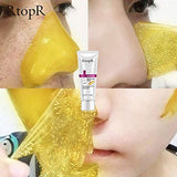 RtopR Blackhead Remover Mask,Tear-off Mask