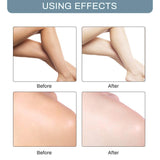 Whitening Cream Effective Lightening Cream for Knees, Elbows, Armpit, Sensitive Areas, Brightens & Nourishes Repairs Skins