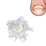 SUPVOX 120pcs Ingrown Toe Nail Correction Patch Paronychia Corrector File Elastic Patch Corrector