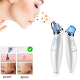 GOODSKY Blackhead Remover Vacuum, Electric Comedo Suction Removal Tool