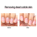 withshyan Oil Free Cuticle Remover Liquid – Quick Dry Cuticle Softener for Nail Care, Loose Skin Eliminator & Exfoliator for Manicure, 0.5 Fl Oz (Pack of 3)