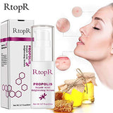 RtopR Propolis Repair Acne Serum, Acne Treatment Serum, Moisturizing Control Oil Anti-Acne Serum - Shrink Pores, Remove Scar Spot Cleaning Essence - Repair Skin