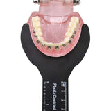 RZJZGZ (6Pcs) Dental Photo Contrast Black Background Board Autoclavable Dental Orthodontic Oral Cheek Retractors Photographic Black Background Backdrop