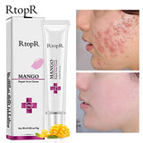 RtopR Mango Repair Acne Cream, Anti-Acne Gel, Facial Care Cream, Remove Acne, Shrink Pores, Whiten and Moisturize, Facial Skin Care