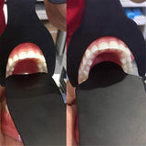Dental Autoclavable Contrasters Intraoral Photographic Black Background Board Latex-Free Orthodontic Photographic Contraster Rubber Palette 6Pcs/Set