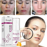RtopR Propolis Repair Acne Serum, Acne Treatment Serum, Moisturizing Control Oil Anti-Acne Serum - Shrink Pores, Remove Scar Spot Cleaning Essence - Repair Skin