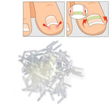 SUPVOX 120pcs Ingrown Toe Nail Correction Patch Paronychia Corrector File Elastic Patch Corrector
