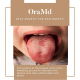 OraMD Original Dentist Recommended Worldwide 100% Pure Breath Freshener for Bad Breath, Halitosis Canker Sores, Gum Boils and Tooth Abscesses - 1 Bottle