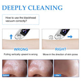 Janolia Blackhead Remover, Pore Vacuum Cleaner with LCD Display and 6 Suction Head, Blackhead Extractor Tool for Blackhead, Whitehead, Acne Removal
