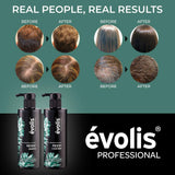 évolis PREVENT Shampoo & Conditioner - Anti Hair Loss - Hair Loss Shampoo & Conditioner for Men and Women - Preventative Hair Loss Treatment (8.5 fl oz Each)