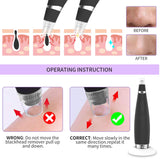 Blackhead Remover Pore Vacuum-VKK Pore Cleaner Acne Extractor Blackhead Whitehead Comedone Face Blackhead Vacuum Remover Tool Wireless Rechargeable (Black)