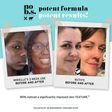 No B.S. 100% Pure Hyaluronic Acid Serum For Face. Anti Aging Face Serum. Ultra Hydrating Face Serum. Potent Formulas. Clean Skincare.
