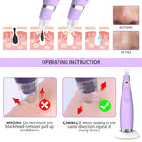 Blackhead Remover Vacuum-VKK Upgraded Blackhead Removal Vacuum Pore Cleaner, Electric Blackhead Whitehead Acne Extractor Tool Wireless Rechargeable (Purple)