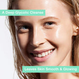10% Glycolic Acid Face Wash - Exfoliating, Non Drying & Foaming AHA Cleanser - Perfect for Anti-Aging, Skin Tone & Texture, Acne, Wrinkles, Pores, Blackheads - Sulfate Free, Oil Free, Low PH - 6 oz.