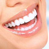 VINFANY Replacement Jet Tips for Dental Water Oral Irrigator Wp-100 Wp-100W Wp-450 Wp-250 Wp-300 Wp-660 Wp-900, 4 Pack