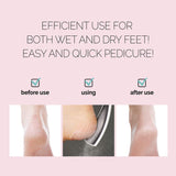 F3 Systems S-Line Emery Foot file, Colossal Double-Sided Pedicure Tool, Effective for Cracked Heel, Ergonomic Design for Easy Grip (2Pcs)