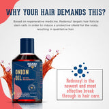 Beardhood Onion Oil with Redensyl for Hair Growth and Anti Hairfall - 20% Red Onion Extract, For Men & Women, Mineral Oil & Paraben Free, 250ml