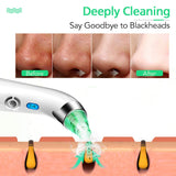 Blackhead Remover Pore Vacuum Cleaner - LONOVE Upgraded Blackhead Vacuum Rechargeable Face Vacuum Comedone Extractor Tool for Blackhead Whitehead Acne Removal, 5 Adjustable Suction Power and 4 Porbes