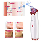 Blackhead Remover Vacuum Electric Pore Cleaner Blackhead Acne Comedone Pimple Extractor Tool Kit with 5 Replaceable Suction Probes, 3 Adjustable Suction Power