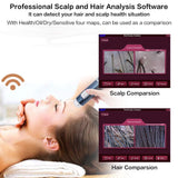 5-200X Scalp Detector, Digital Hair Skin Analyzer Microscope for Hair Follicle Testing and Skin Analysis, Magnifier Analyser Device with 200MP Camera Wireless Wifi + USB Connect